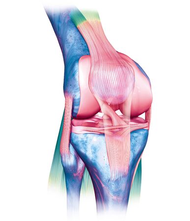 Accurate medical 3D illustration showing painful knee joint with highlighted anterior and posterior cruciate ligament, meniscus, articular cartilage, femur and tibia.の写真素材
