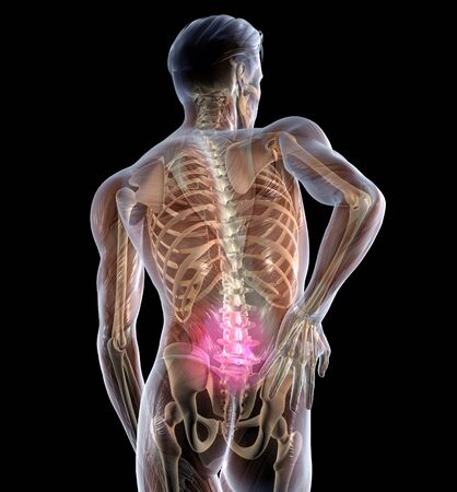 3D illustration showing backache of a man with spine, skeleton und musclesの写真素材