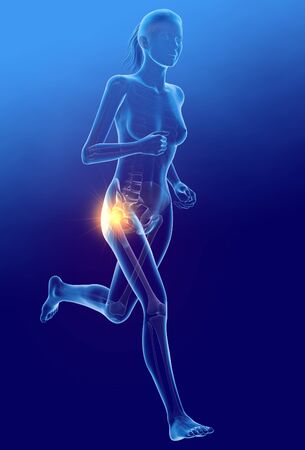 Running woman with painfuk hip joints and skeleton, medically 3D illustration on blue backgroundの写真素材