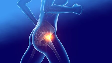 Woman with arthritic hip joints and skeleton, medically 3D illustration on blue backgroundの写真素材