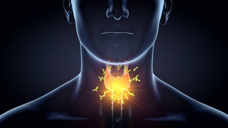 Medically 3D illustration showing antibodies attacking thyroid gland of a man.
の写真素材