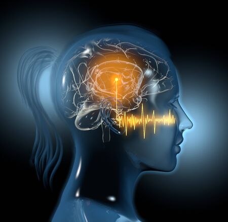 Tinnitus, sound waves and highlighted auditory cortex of a womanの写真素材
