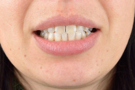 Close up of healthy teeth of young woman. Dental health care. Hygiene teeth. Dentistry