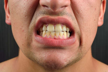 Detailed image of man showing his teeth. Dental health care. Hygiene. Dentistryの写真素材