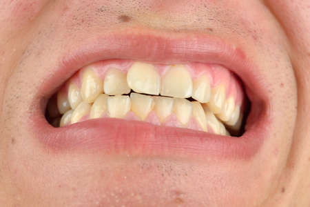 Detailed image of man showing his teeth. Dental health care. Hygiene. Dentistryの写真素材