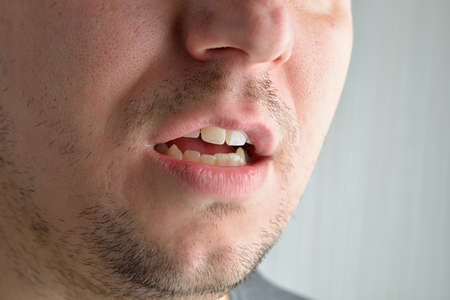 Lips, short beard of a young man. Concept photo of male sexuality and skin medical careの写真素材