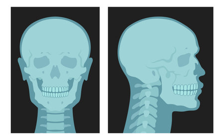 X rays shots of human skull front side view set vector flat illustration. Skeleton bone roentgenのイラスト素材