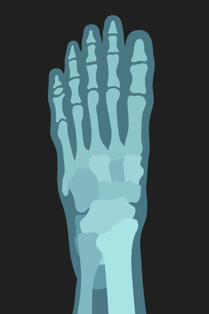 X ray image of human foot top view transparent silhouette bone anatomy vector flat illustrationのイラスト素材
