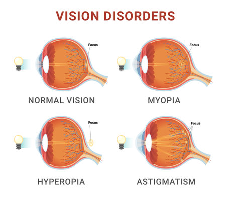 Vision disorders medical education scheme with names and eyeball structure vector illustrationのイラスト素材