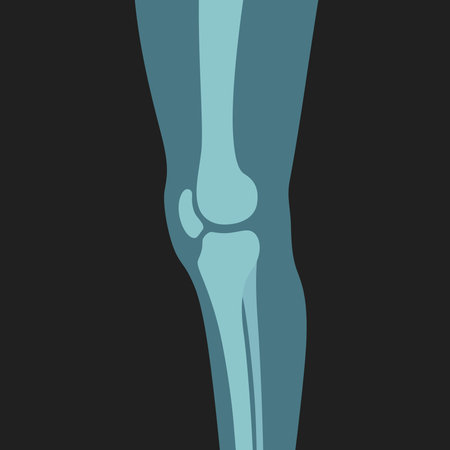 X ray of knee orthopedic human body joint leg skeleton shot vector flat illustration