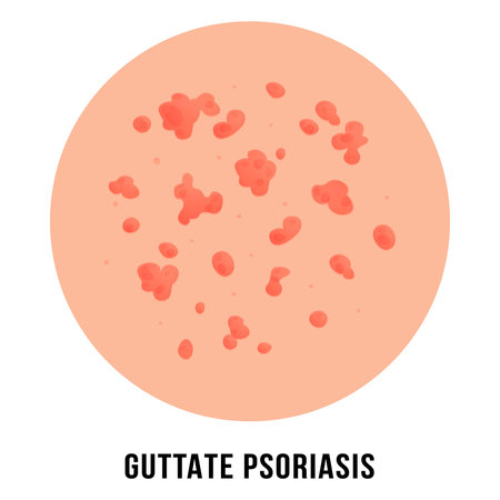 Guttate psoriasis vector illustration isolated on white backgroundのイラスト素材