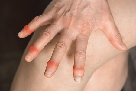 Elderly woman's hands with sore fingers. Finger treatment concept.の写真素材