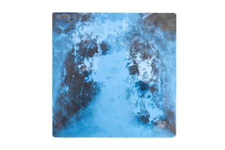 Old, used x-ray image scratched and dirty medical object.