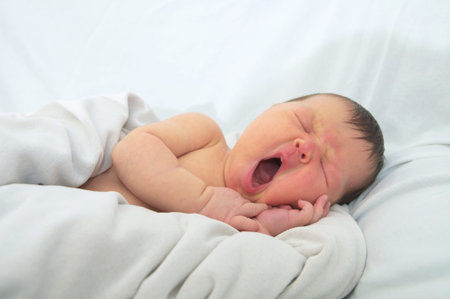 funny baby face,newborn with jaundice on white blanket, infant healthcare concept
