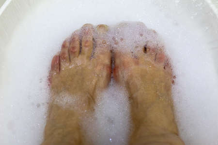 neglected feet and pedicure, foot care. feet in foamy water.の写真素材