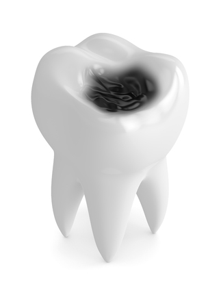 3d render of tooth with decay isolated over white backgroundの写真素材