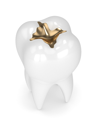 3d render of tooth with dental gold filling over white backgroundの写真素材