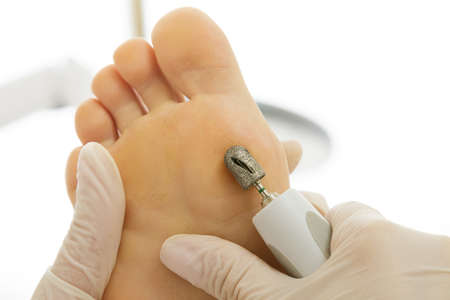 Pedicure master during work. Closeup of female feet and hands in gloves with a special machine tool.の写真素材