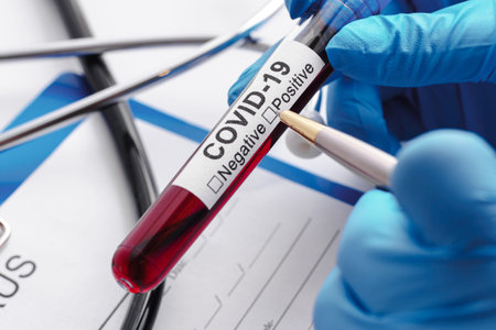 Scientist hand with a blood sample of COVID-19
