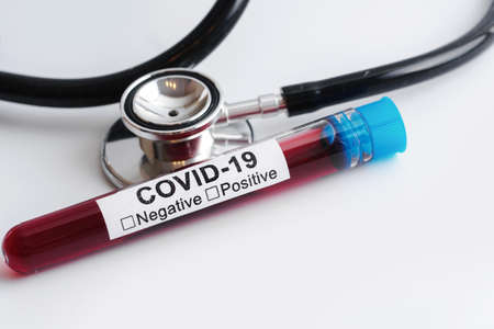 Blood samples and stethoscope on white backgroundの写真素材