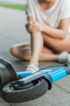 Young woman suffering from knee pain after e-scooter riding accidentの写真素材