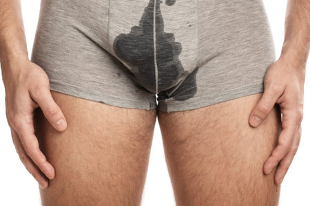 Man with wet briefs because of urinary incontinence