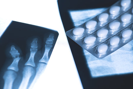 X-ray image and blister pack of white tablets