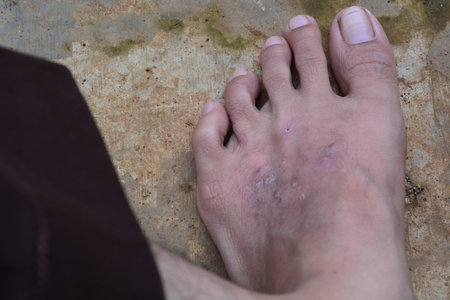 Photos of itchy feet, photos with the theme of health