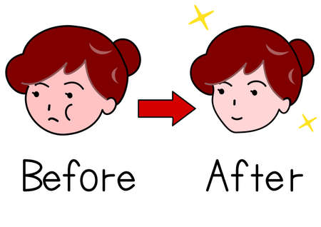 Face of woman before and after Shape upのイラスト素材