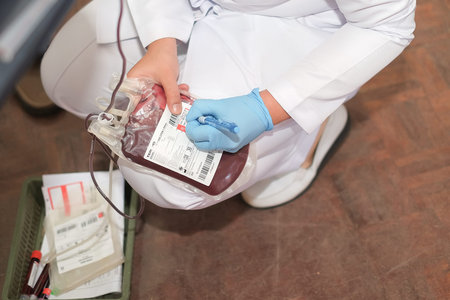 Muadzam Shah,  Malaysia - February 21st, 2018 : Unidentified hospital staff labeling  blood bag...