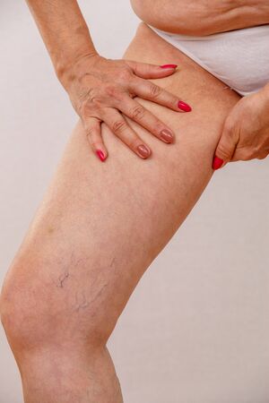 Elderly woman in white panties shows cellulite and varicose veins on a light isolatedの写真素材