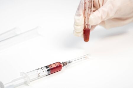 the gloved hand of a laboratory assistant holds a test tube with a blood sample on a white background. also in the photo is a syringe with a blood sampleの写真素材