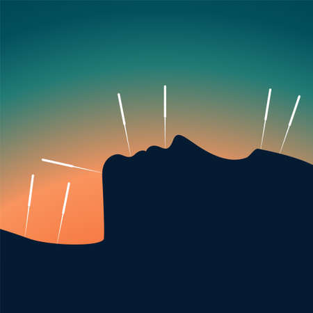 Acupuncture banner with woman face silhouette and chinese needles. Alternative medicine and treatment poster template. Medical vector eps illustrationのイラスト素材