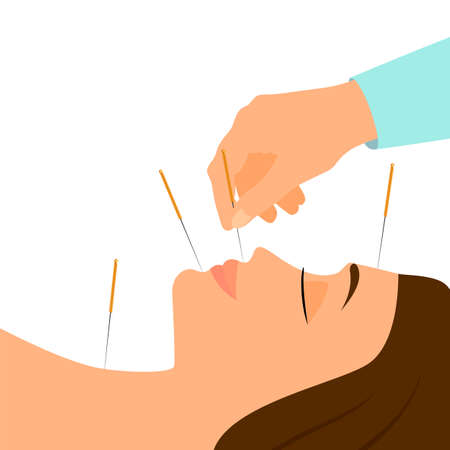 Acupuncture banner with woman face and chinese needles. Alternative healthcare and medicine poster template. Medical vector eps illustrationのイラスト素材