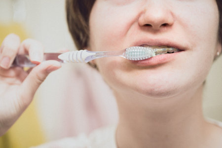 girl with braces brushing her teeth. close-up. healthy even teeth and orthodontics