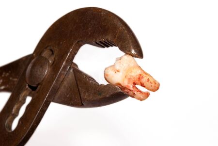 Bloody tooth removed with a rusty gripperの写真素材