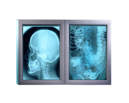 double x-ray monitors isolated with clipping pathの写真素材