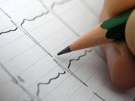 Close up of EKG(electrocardiogram).Doctor looking at EKG results.       の写真素材