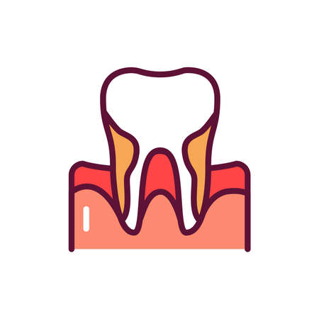 Periodontitis color line icon. isolated vector element. Outline pictogram for web page, mobile app, promoのイラスト素材