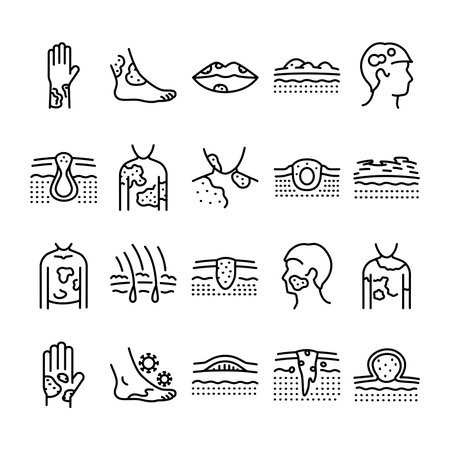 Skin diseases line icons set. Dermatology problems: disease vitiligo acne bruise blistering etc.のイラスト素材