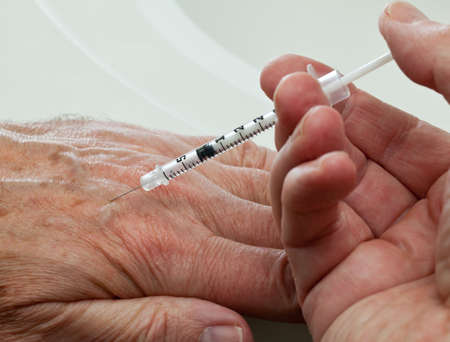 Injection into vein of senior man hand from small hypodermic needleの写真素材
