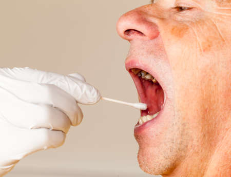 Gloved hand taking a bodily fluid sample for DNA test from senior male personの写真素材