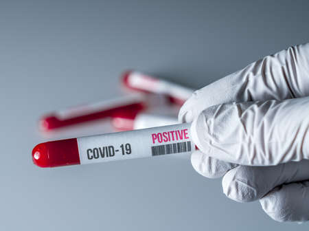 Medical glove holding a tube of blood with a positive result for test for Covid-19 or coronavirusの写真素材