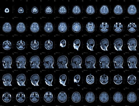 Brain and head MRI or CT images