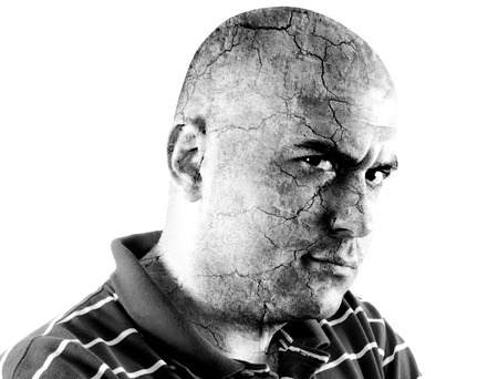 Bald man is very angry