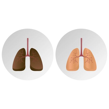Comparison between healthy lung and cancer lung isolated on white . Icon illustrationのイラスト素材