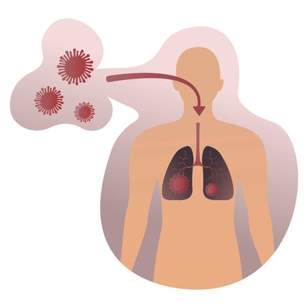 Infectious disease. Medical Infographic set with icons and other elements. 2019-nCoV coronavirus concept with virus enters the lungs human on white biohazard virus sign backgroundのイラスト素材