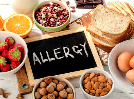 Food allergy. Allergic food on  wooden background.の写真素材