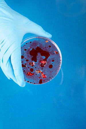 Hand in blue glove holding petri dish with bacterium. Microbiology science. Top view.の写真素材