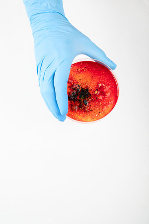 Hand in blue glove holding petri dish with bacterium. Microbiology science. Top view.の写真素材